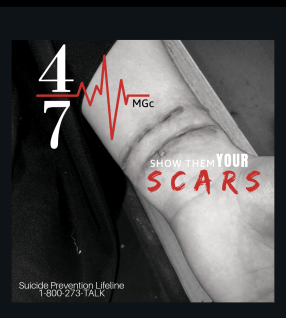 Scars
